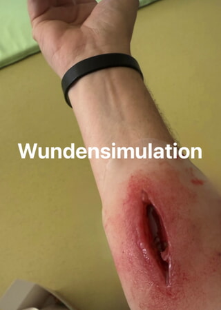 Wundensimulation